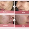 Medicube Salmon PDRN Pink Peptide Serum