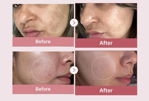 Medicube Salmon PDRN Pink Peptide Serum