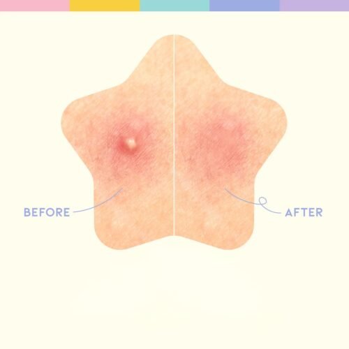 OOTD Beauty Star Spot Patch