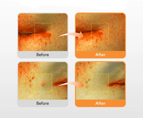 Abib Glutathiosome Dark Spot Serum Vita Drop